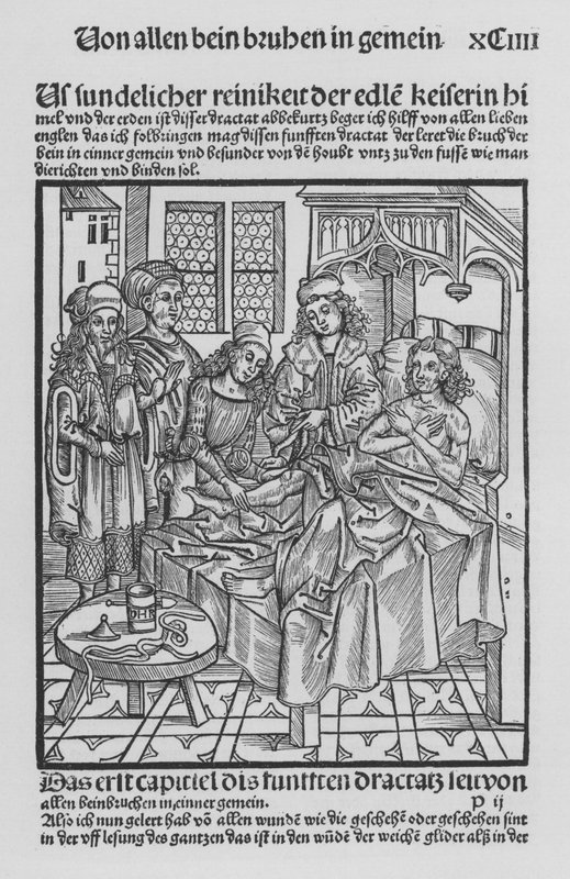 Hieronymus Brunschwig Cirurgia könyve (litho) alkotó: (after) German School