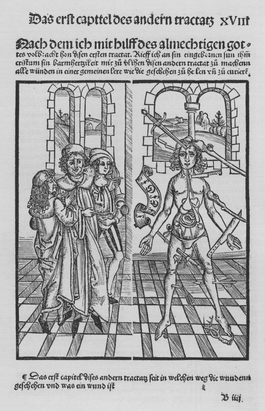 Hieronymus Brunschwig Cirurgia könyve (litho) alkotó: (after) German School