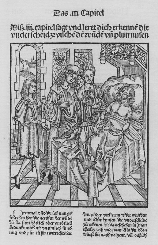 Hieronymus Brunschwig Cirurgia könyve (litho) alkotó: (after) German School
