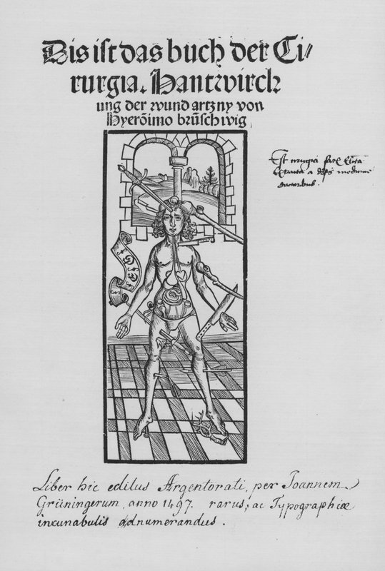 Hieronymus Brunschwig Cirurgia könyve (litho) alkotó: (after) German School