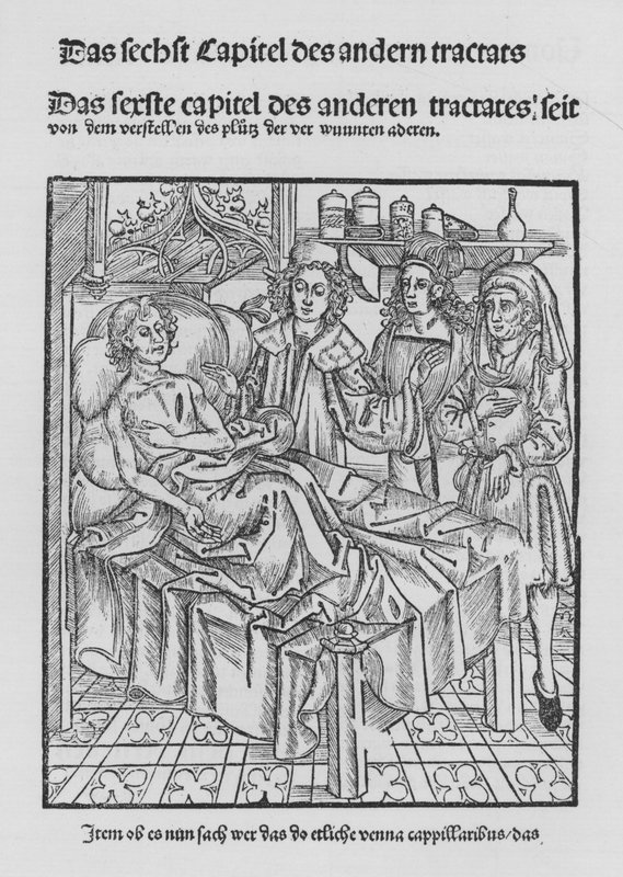 Hieronymus Brunschwig Cirurgia könyve (litho) alkotó: (after) German School
