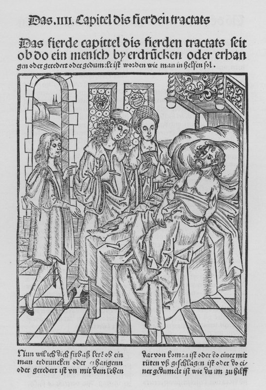 Hieronymus Brunschwig Cirurgia könyve (litho) alkotó: (after) German School