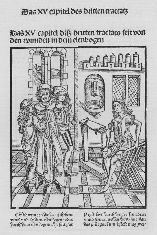 Hieronymus Brunschwig Cirurgia könyve (litho) alkotó: (after) German School