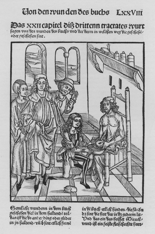 Hieronymus Brunschwig Cirurgia könyve (litho) alkotó: (after) German School