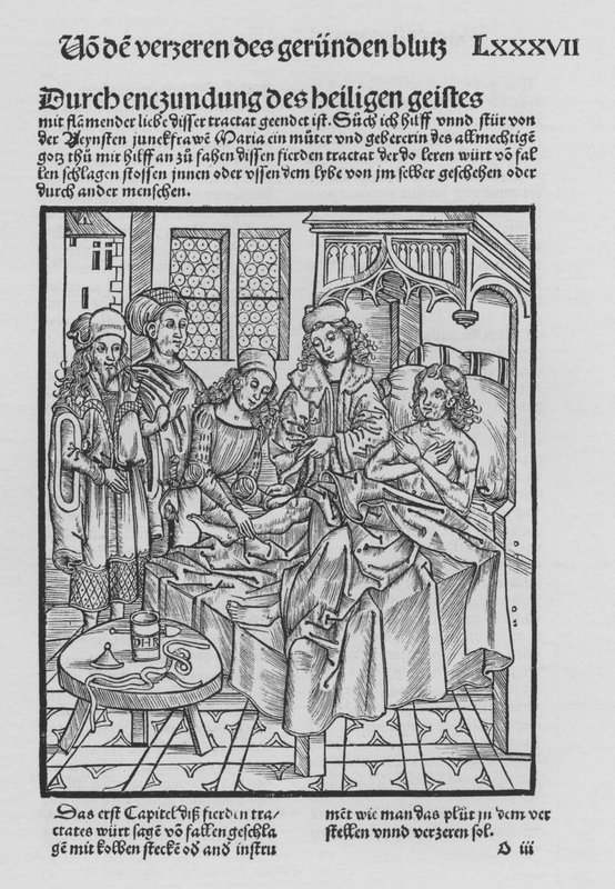 Hieronymus Brunschwig Cirurgia könyve (litho) alkotó: (after) German School
