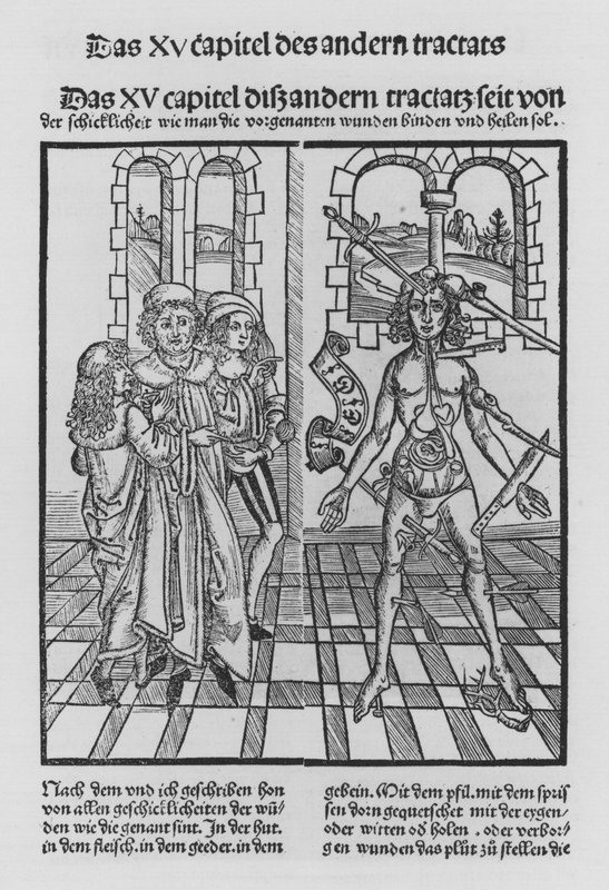 Hieronymus Brunschwig Cirurgia könyve (litho) alkotó: (after) German School