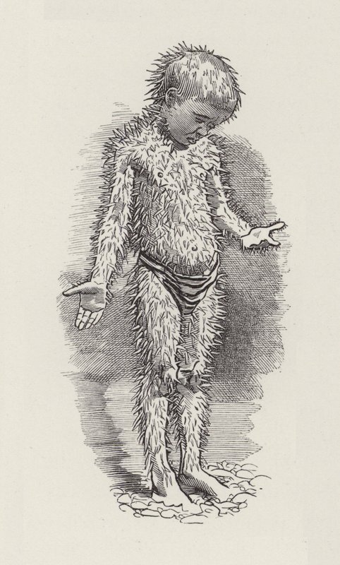 Illusztráció: Charles Kingsley: The Water-Babies (metszet) alkotó: Edward Linley (after) Sambourne