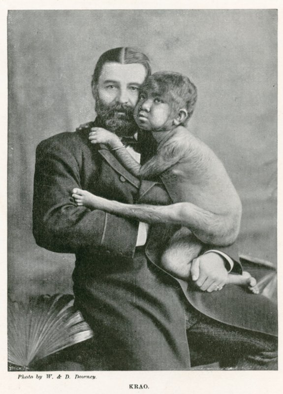 Krao, The Missing Link, kiállítva a londoni Westminster Aquariumban 1887-ben alkotó: English Photographer