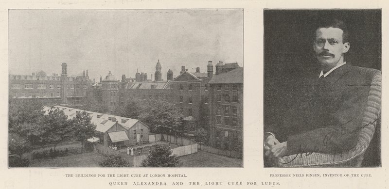 Alexandra királynő és a lupusz fénygyógyszere alkotó: English Photographer