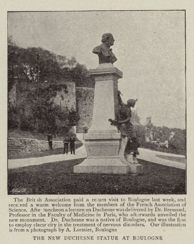 Az Új Duchesne-szobor Boulogne-ban alkotó: English Photographer