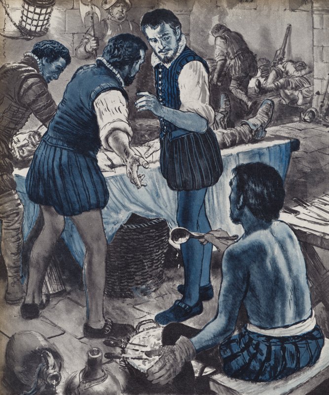 Ambroise Pare, katonai sebész, amikor kifogyott az olaj (litho) alkotó: English School