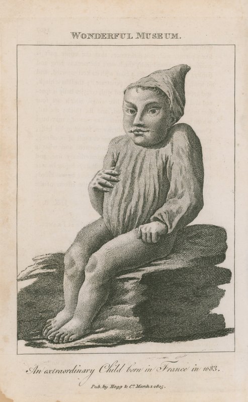 Rendkívüli gyermek született Franciaországban 1683-ban alkotó: English School