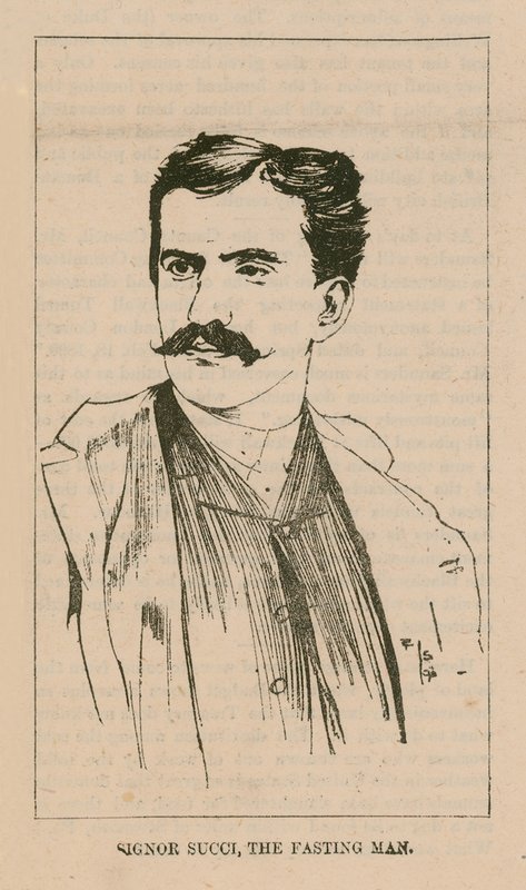 Signor Giovanni Succi portréja alkotó: English School