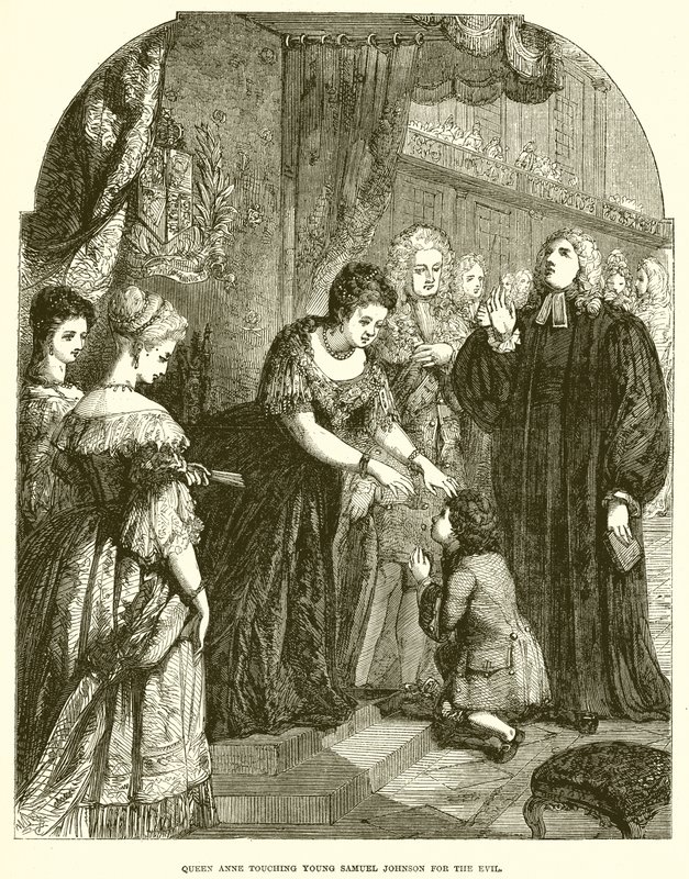 Anna királynő megérintette a fiatal Samuel Johnsont a gonoszért alkotó: English School