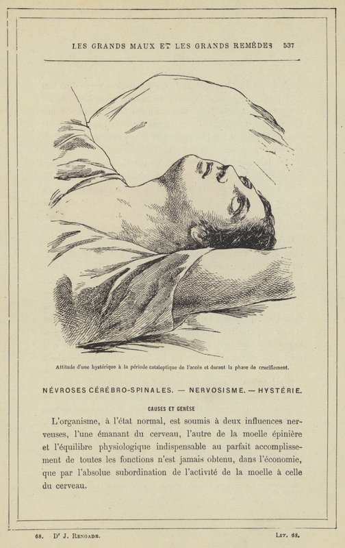 A hisztérikus hozzáállása a hozzáférés kataleptikus időszakában és a keresztre feszítés szakaszában (színes litho) alkotó: French School