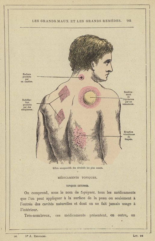 A leggyakoribb riasztószerek (színes litho) összehasonlító hatásai alkotó: French School