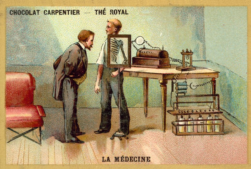 Röntgenfelvételen átesett beteg (chromolitho) alkotó: French School