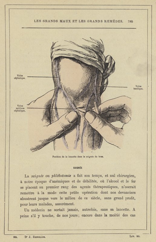 A lándzsa helyzete a karban (színes litho) alkotó: French School