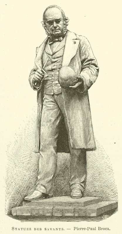Tudósok szobrai, Pierre-Paul Broca (metszet) alkotó: French School