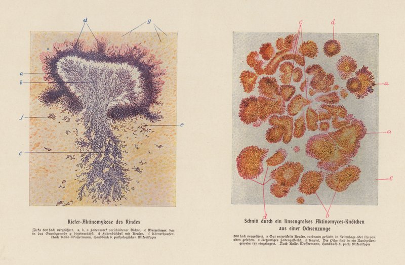 Actinomyces bovis (színes litográfia) alkotó: German School