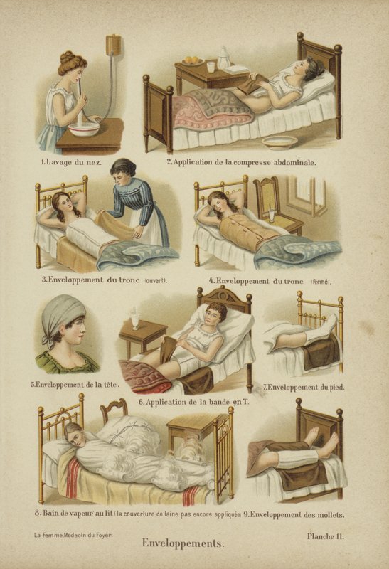 Kötszerek, pakolások és borogatások (színes litho) alkotó: German School