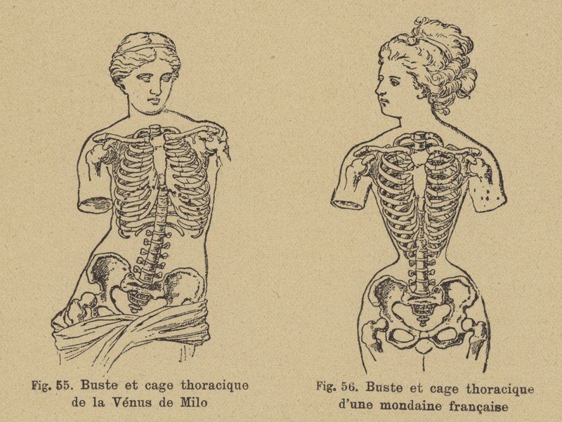 A Venus de Milo mellkasának és bordájának formájának összehasonlítása egy 19. század végi francia társasági emberével alkotó: German School