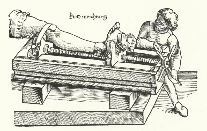 Készülék a sérült láb kiegyenesítésére (gravírozás) alkotó: German School