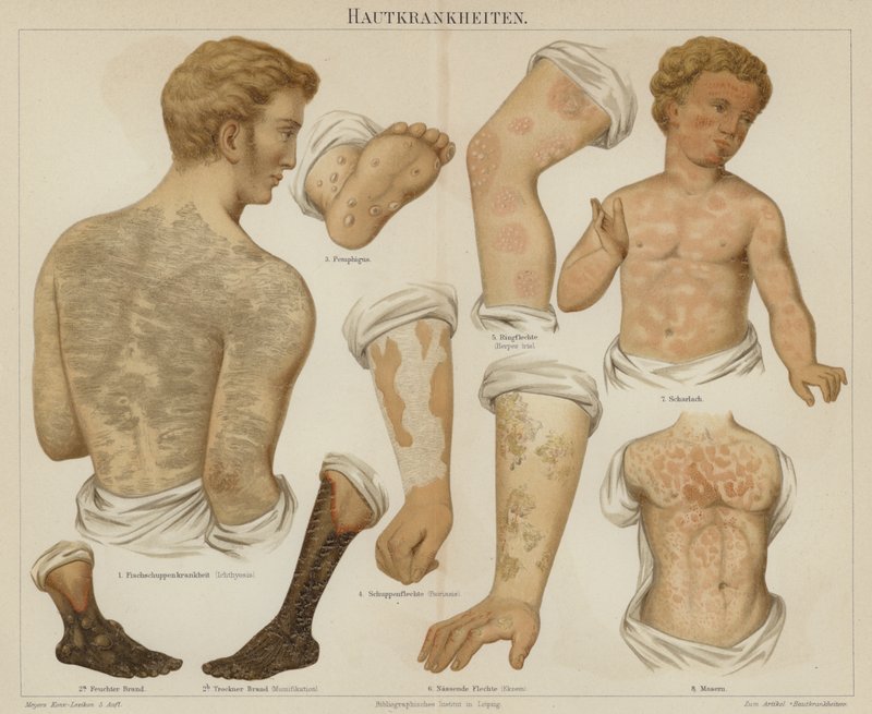 Bőrbetegségek (színes litho) alkotó: German School