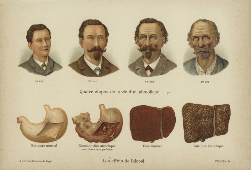 Az alkoholfogyasztás hatásai (színes litho) alkotó: German School