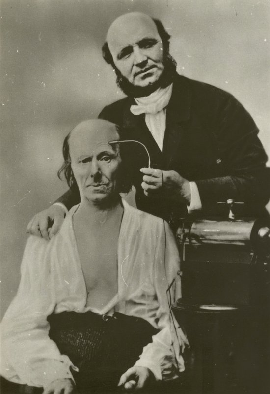 Duchenne de Boulogne francia neurológus elektrofiziológiai készülékét használja egy idős emberen. alkotó: Guillaume Benjamin Armand Duchenne de Boulogne