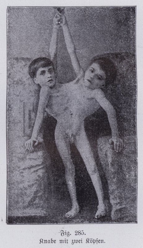 Giacomo és Giovanni Battista Tocci, olasz ikrek (f/w fotó) alkotó: Italian Photographer
