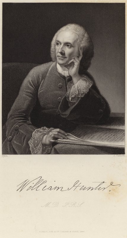 William Hunter portréja alkotó: James Baker Pyne