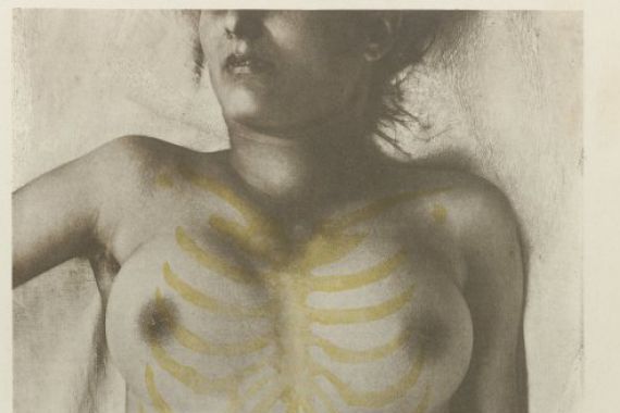Giulio Chiarugi (attributed to)
