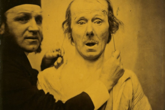 Guillaume Benjamin Armand Duchenne de Boulogne