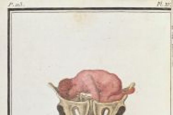 P. Chapparre