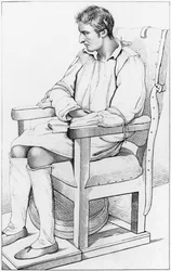Demencia, illusztráció a „Des Maladies Mentales figyelembe véve az orvosi, higiéniai és orvosi-jogi viszonyban” című könyvből, Etienne Esquirol (1772-1840) 1838