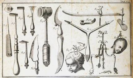 Különböző típusú sebészeti eszközöket, kalapácsot, fésűkagylót, kést ábrázoló sebészeti tábla az agy eltávolítására. Benoit Louis Prevost (1735-1809) metszete 18. század