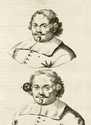 Egy példa a köpölyözésre, Frederik Dekkers The Practice of Medicine című könyvéből, 1694
