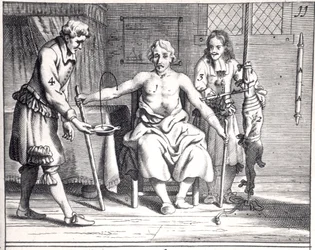 Vérátömlesztés kutyából, Johannes Schultes (1595-1645) Armamentarii Chirurgici című művéből, Amszterdamban kiadva, 1671