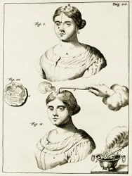 Epilepsziában szenvedő betegek kezelése Frederik Dekkers gyakorlataiból az orvosi gyakorlatban, 1694