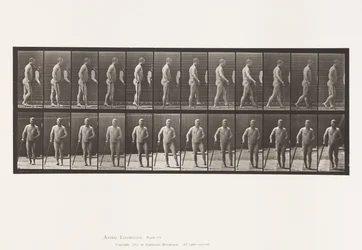 552. tábla.Hemiplegia; Séta bottal, 1885