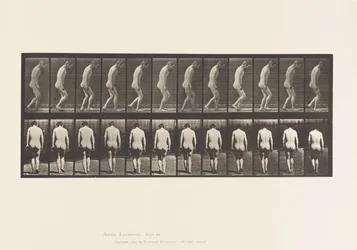 558. tábla.Paraplégia; Részleges; Séta, 1885
