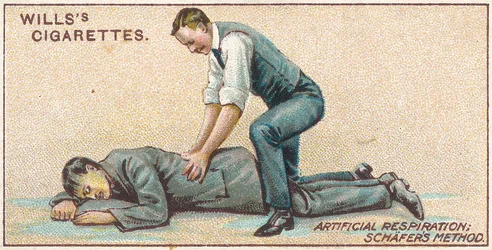 Mesterséges lélegeztetés, Schafers-módszer, 25. sz. a Willss Cigarettes kártya elsősegély-sorozatából, 1913