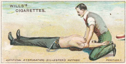 Mesterséges lélegeztetés, Sylvesters módszer – 1. pozíció, 17. sz. a Willss Cigarettes kártyák elsősegély-sorozatából, 1913