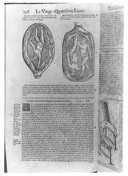 Foetus, illusztrációja Ambroise Pare (1509-90) életműveiből, megjelent Lyonban, 1641