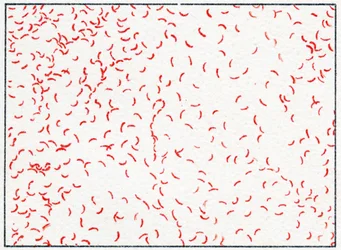 Vibrio cholerae baktérium 1890 körül (színes kromolitográfia)