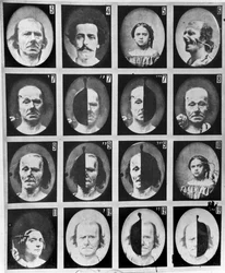 Fiziognómiai tanulmányok, Duchenne de Boulogne: „Az emberi fiziognómia mechanizmusa vagy a szenvedélyek elektrofiziológiai elemzése”, 1876, Párizs