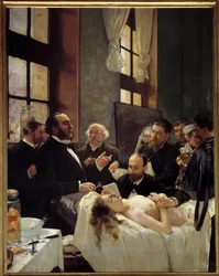 Dr. Jules-Émile Péan (1830-1898) a Saint-Louis kórházban tanít az erek leszorításának felfedezéséről. „A műtét előtt”. Henri Gervex (1852-1929) festménye, 1887. M. 2,42 x 1,88 m, Párizs, Musée d