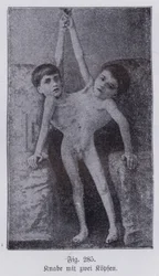 Giacomo és Giovanni Battista Tocci, olasz ikrek (f/w fotó)