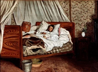 A rögtönzött mentőautó (Claude Monet megsebesült). Jean Frédéric Bazille (1841-1870) festménye